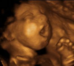 fetal yawning